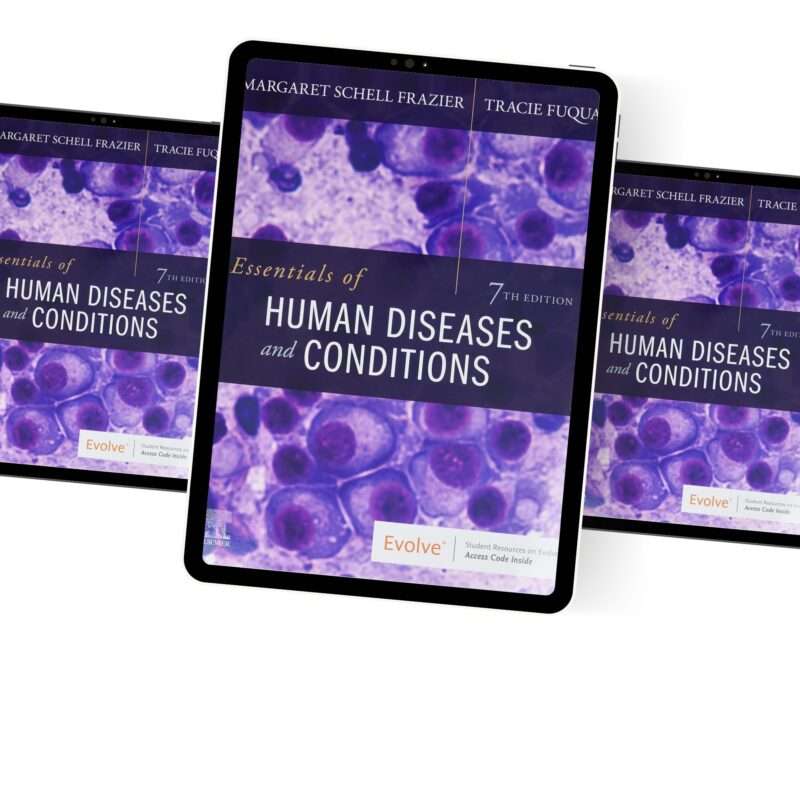 Essentials Of Human Diseases And Conditions Th Edition By Frazier Test