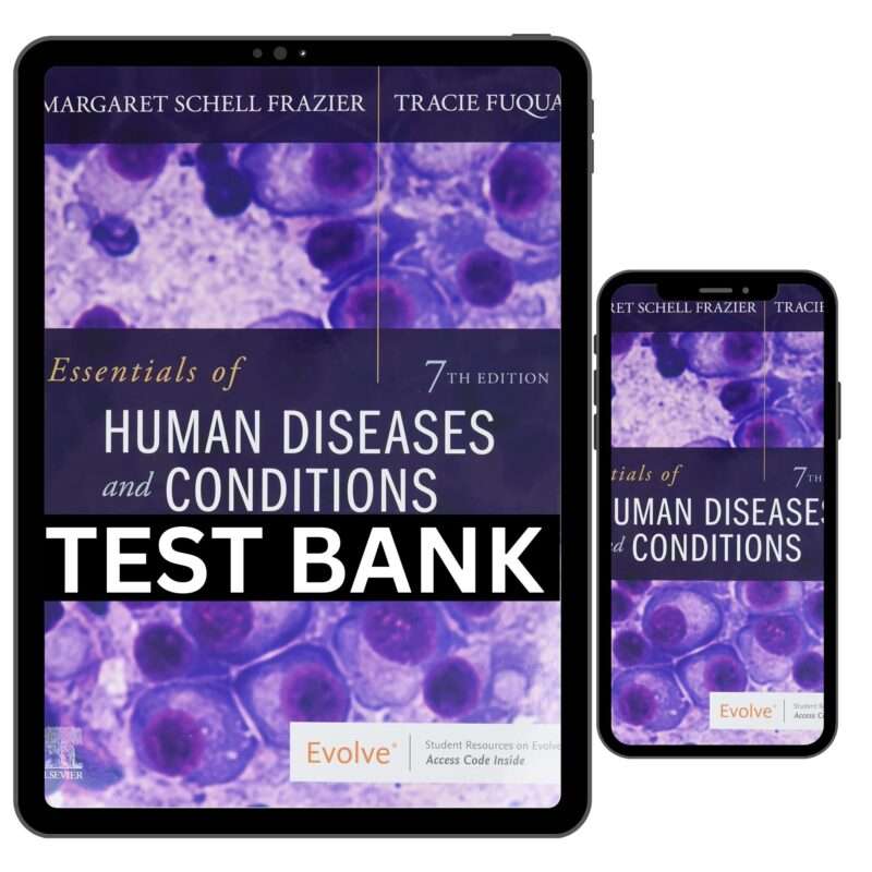 Essentials Of Human Diseases And Conditions 7th Edition By Frazier Test Bank