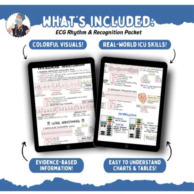 2025 ECG Rhythm Recognition and Interpretation Packet (15 Pages) Cardiac ICU Study Review, Nursing Student Cheat Sheet - Image 4