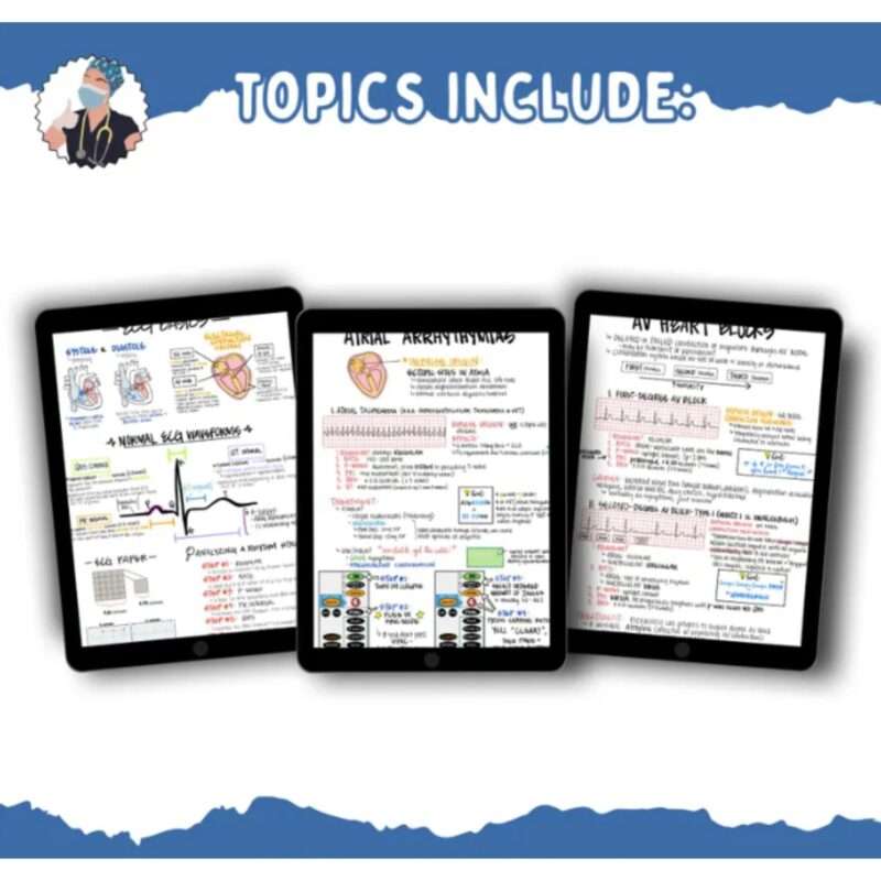 2025 ECG Rhythm Recognition and Interpretation Packet (15 Pages) Cardiac ICU Study Review, Nursing Student Cheat Sheet - Image 6